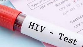 Güney Kıbrıs’ta Ayda Ortalama 12-15 Yeni HIV Vakası