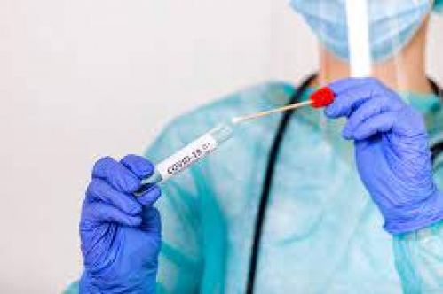 Sağlık Bakanlığı Girne'de ücretsiz PCR testi yapacak