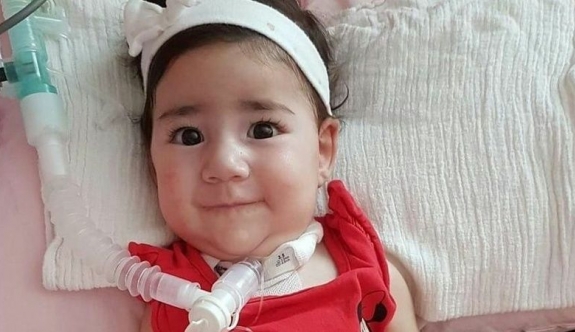 Makarios Hastanesi Yoğun Bakım Servisinde Yatan Asya Bebeğin Durumunun İyiye Gittiği Duyuruldu