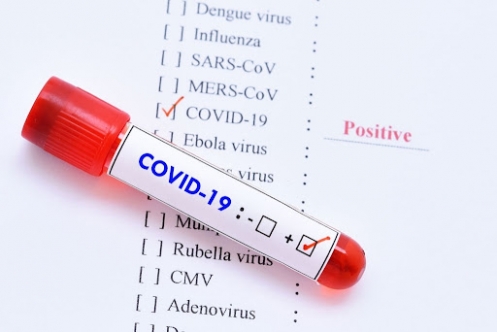 Coronavirüsten Bugün 2 Ölüm!