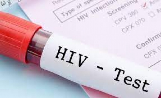 Güney Kıbrıs’ta Ayda Ortalama 12-15 Yeni HIV Vakası