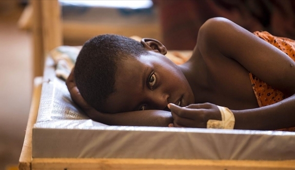 Kamerun’da Kolera Salgınında Vaka Sayısı 4 Bin 500’ü Aştı