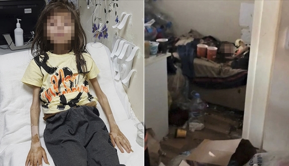Çöp Evde Atıkların Arasında Bulunan Çocuk Antalya'da Devlet Koruması Altına Alındı