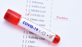 Coronavirüsten Bugün 2 Ölüm!