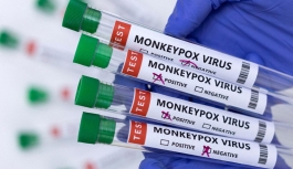 DSÖ'den Maymun Çiçeği Virüsü Açıklaması