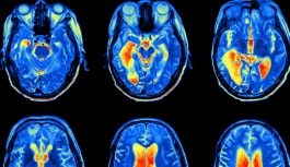 Kronik ağrıların beyindeki kaynağını inceleyen araştırma, hastalara umut olabilir
