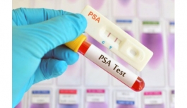 Ücretsiz prostat kanseri testi yapılacak